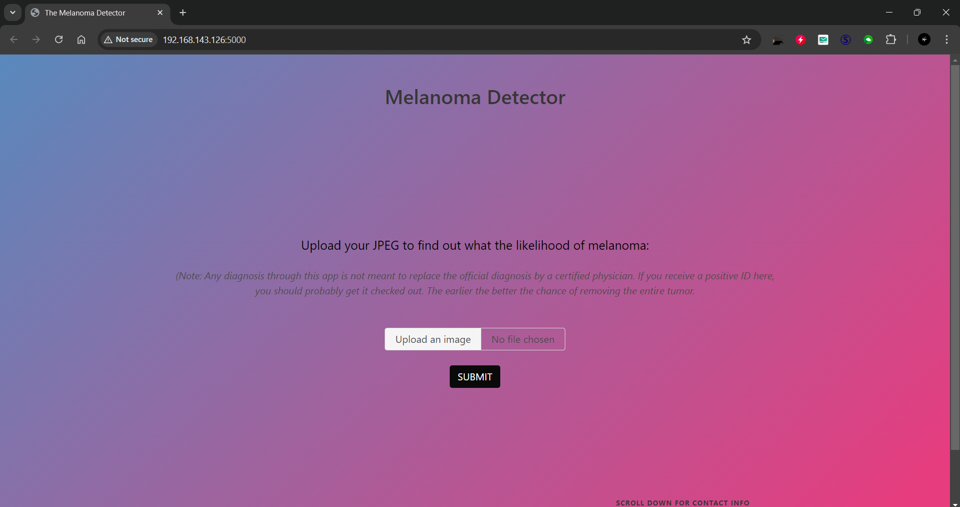 Melanoma Detector web app